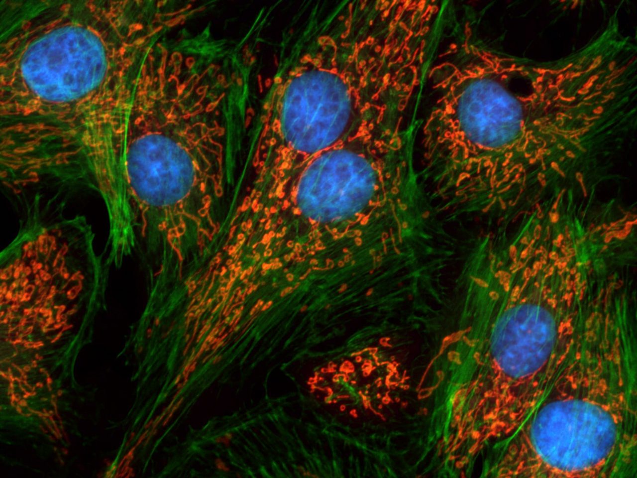 Endothelial Nox2 limits systemic inflammation and hypotension in endotoxemia by controlling expression of toll-like receptor 4